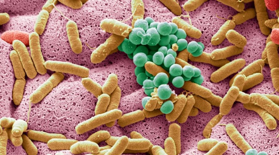 Microbiota-intestinal
