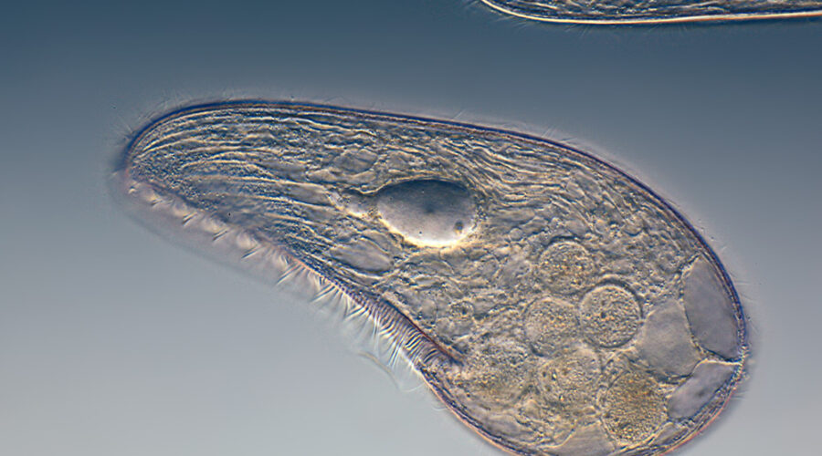Mikrofoto.de-Blepharisma_japonicum_15