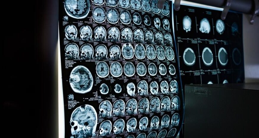 México y Cuba desarrollan molécula para tratamiento del Alzheimer